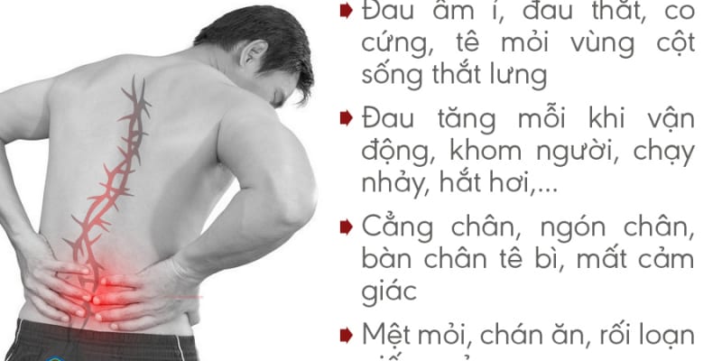 Triệu chứng gai cột sống thắt lưng ở người bệnh