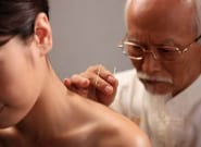 Cách châm cứu thoái hóa đốt sống cổ
