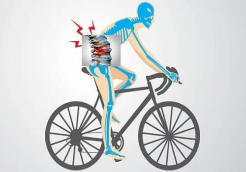 Bị đau thần kinh tọa có nên đạp xe không