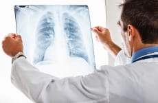 Tìm hiểu về hội chứng đông đặc phổi là gì?