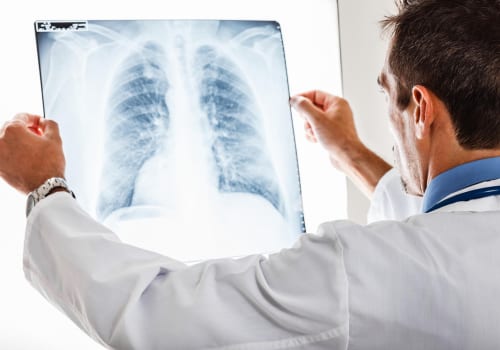 Tìm hiểu về hội chứng đông đặc phổi là gì?