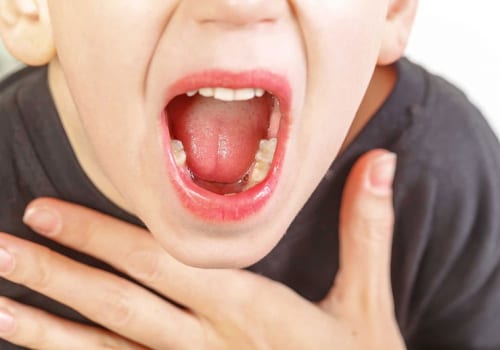 Tìm hiểu về bệnh Viêm họng mủ ở trẻ em