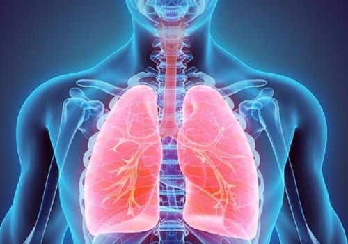Tìm hiểu viêm phổi thùy là bệnh gì?